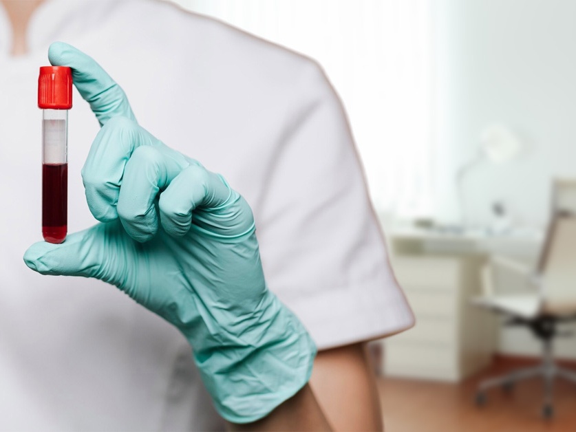 Hematologie Medicentrum Beroun - MUDr. Jan Straub