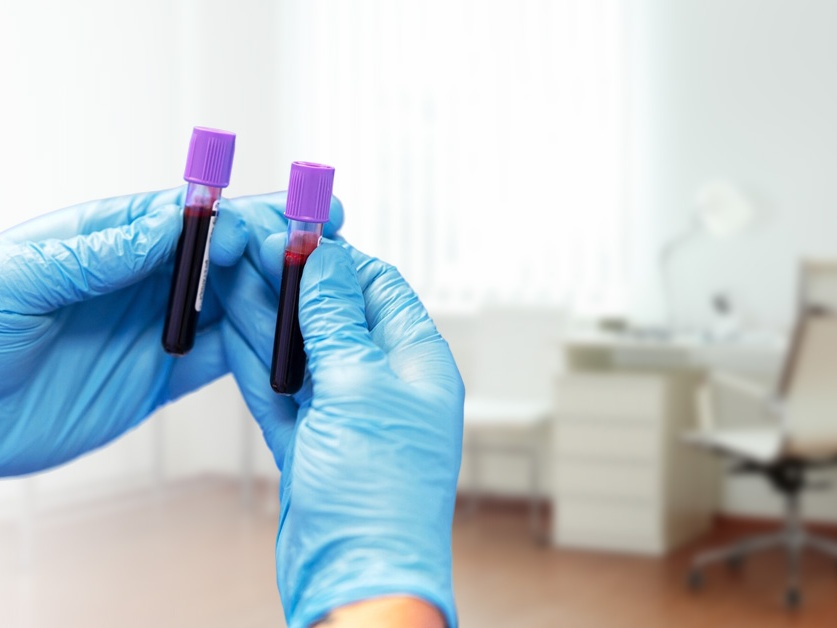 SPADIA - odběrové místo Dobřichovice